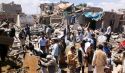 الحرب على اليمن تتسبب في كارثة إنسانية فوق كارثة الحرب المنسية